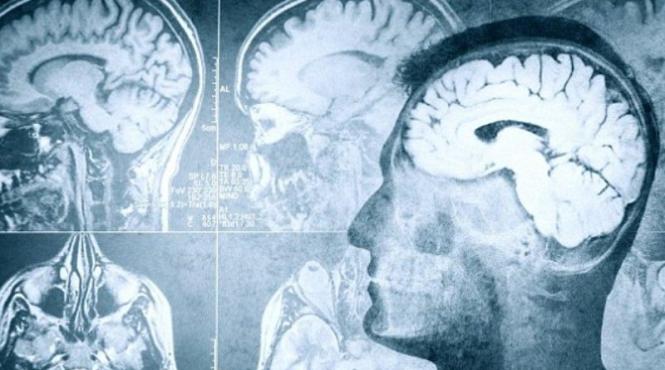 dupa moarte creierul nostru intra in depresie