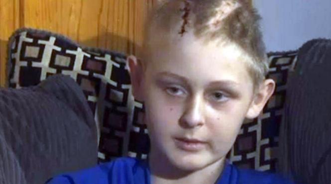 un baiat s a trezit din coma dupa ce parintii sai si au dat acordul ca organele sa i fie recoltate