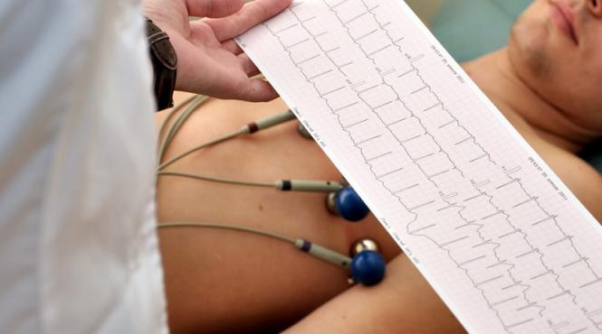 radiografia si electrocardiograma n au imbatranit