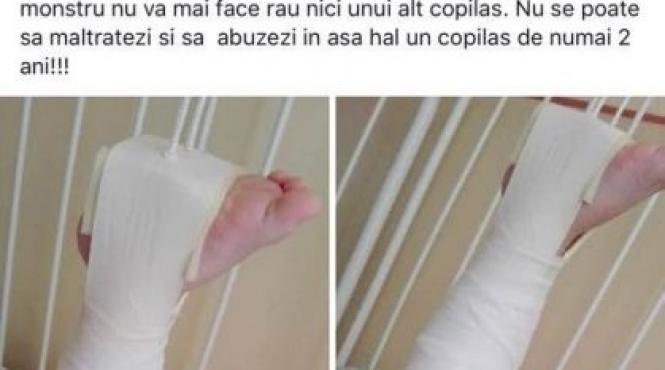 un copil de doi ani a ajuns la spital cu fractura de femur dupa ce ar fi fost agresat la gradinita
