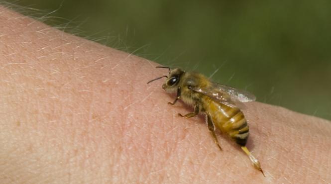 incredibil un barbat a murit dupa ce a fost intepat de o viespe