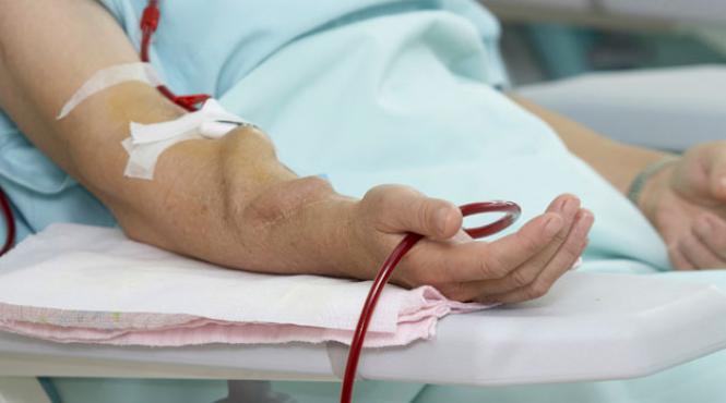 hemodializa si fistula arteriovenoasa tot ce trebuie sa stii