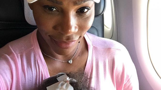 fiica serenei williams s a imbolnavit