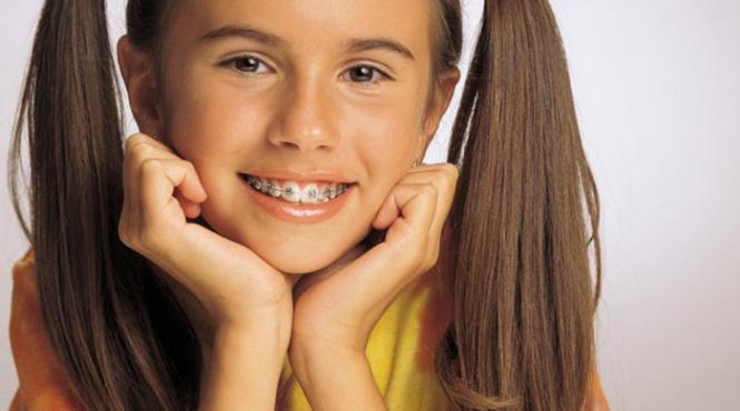 vouchere de pana la 990 de lei pentru aparate ortodontice fixe destinate copiilor
