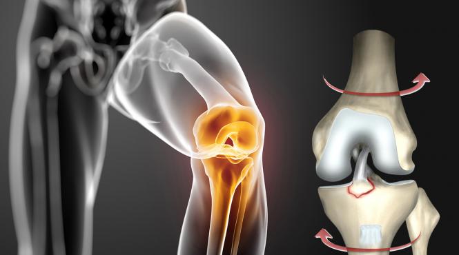 leziunea de ligament incrucisat anterior cum o tratam video 1