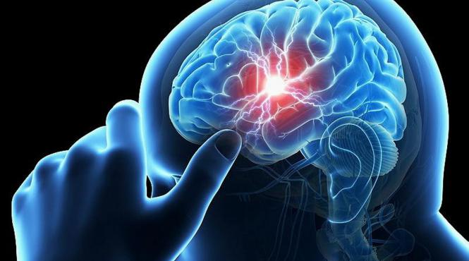 tratament salvator pentru pacientii cu avc