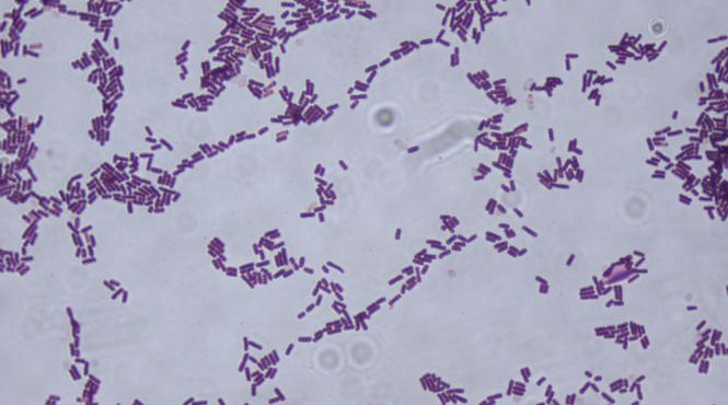 oamenii de stiinta au descoperit un nou mod prin care bacteriile supravietuiesc in fata tratamentului