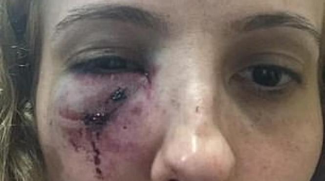 o mama romanca din anglia batuta crunt de 10 adolescenti chiar in fata casei