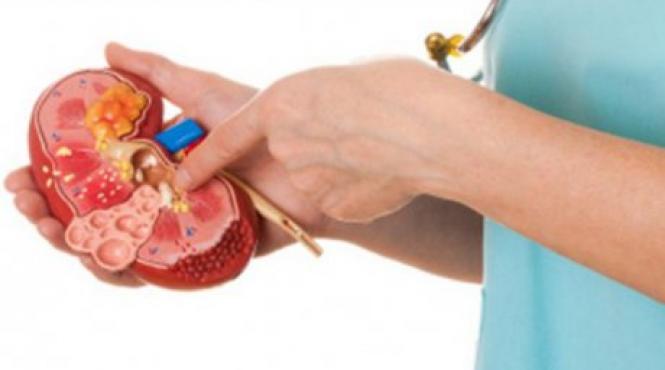 12 reguli de aur pentru prevenirea sau dizolvarea pietrelor biliare