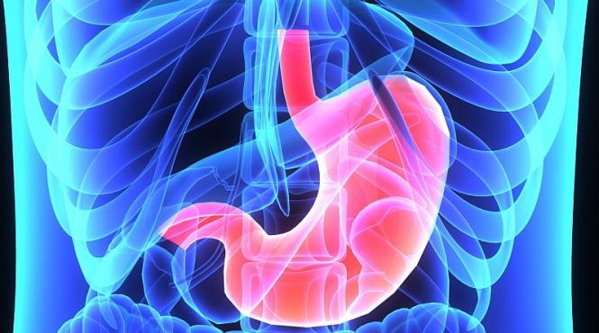 chirurgul construieste un inel musculos din stomac in refluxul gastro esofagian grav