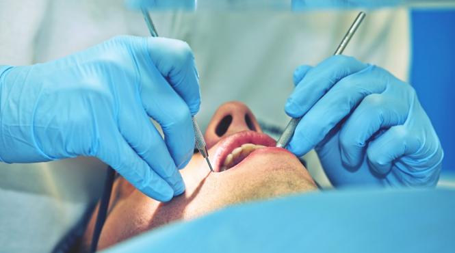 detartraj sigilari dentare fluorizare si alte metode de profilaxie dentara