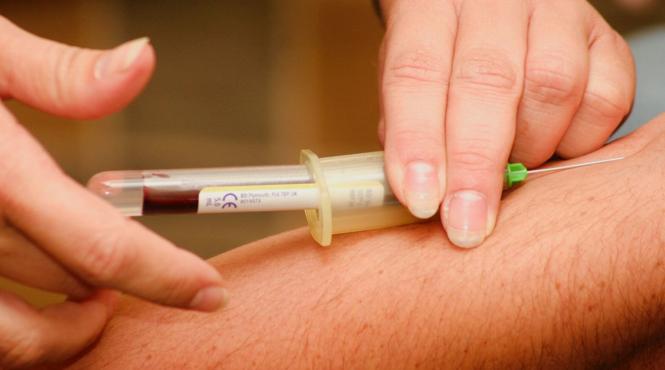 analize medicale pe care trebuie sa le faci in fiecare an