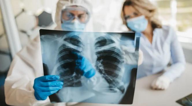 pneumonia misterioasa care a omorat 4 oameni in argentina este de fapt boala legionarilor