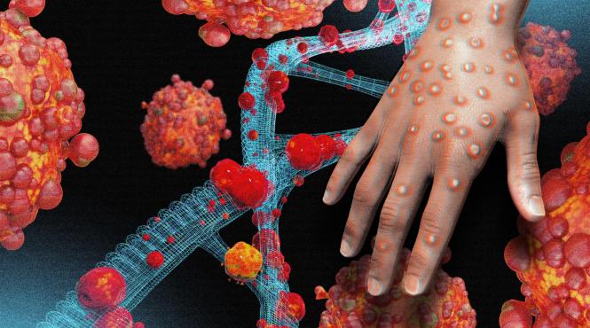 oms bilantul infectiilor cu variola maimutei a ajuns la circa 70 000 la nivel global