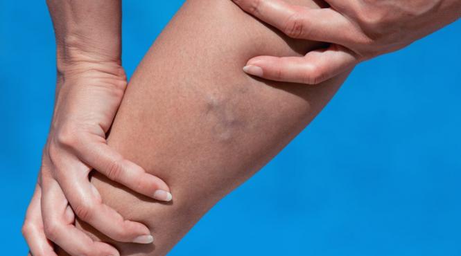 calatoriile cu avionul sau masina pot creste riscul aparitiei cheagurilor de sange ce putem face explica medicul florin bloj