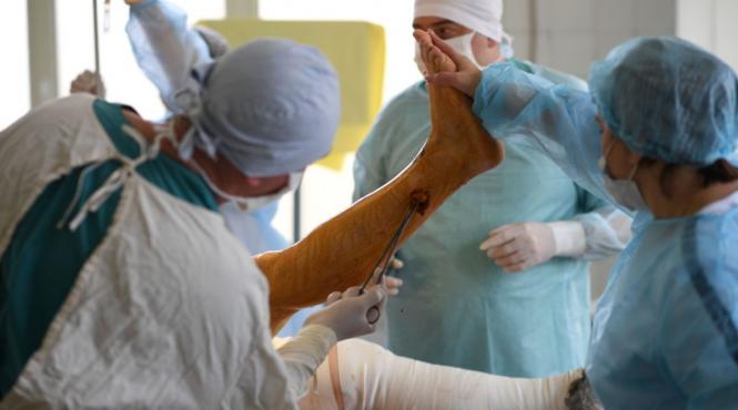 operatie picior amputat baiat vatra dornei spital sf maria iasi