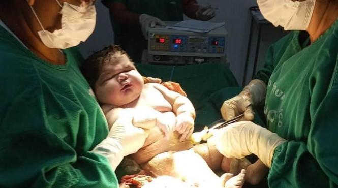 bebelus urias brazilia