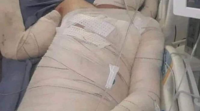 fotbalist dat foc protest mort