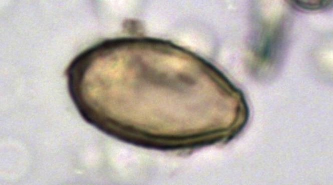 alerta sanatate china trei cazuri ciuma bubonica mongolia interioara