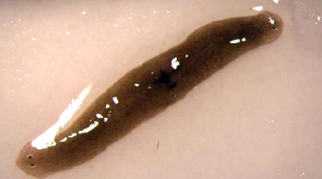 descoperire socanta gasit medicii canberra creier femeie