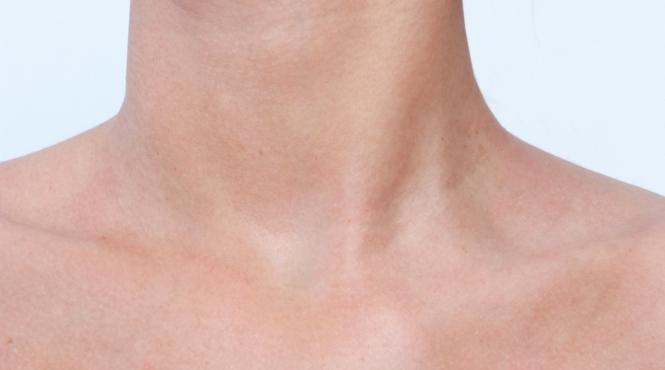 exercitiu face piele mai tanara