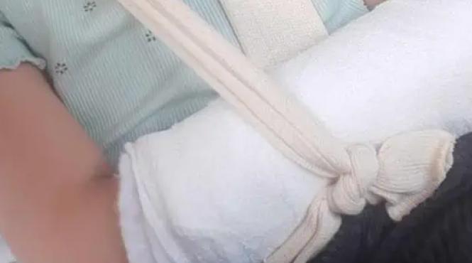 revoltator medici alba nu au vazut mana rupta fetita 5 ani recomandat unguent durere