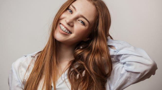 5 motive pentru care ar trebui sa ai dintii drepti