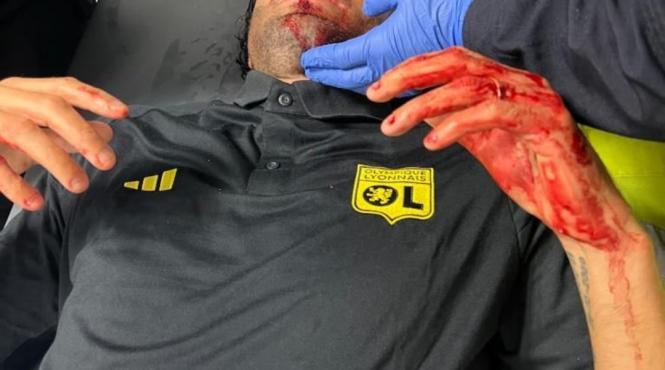 meciul marseille lyon reprogramat dupa amanarea cauzata de atacul asupra autocarului lionez