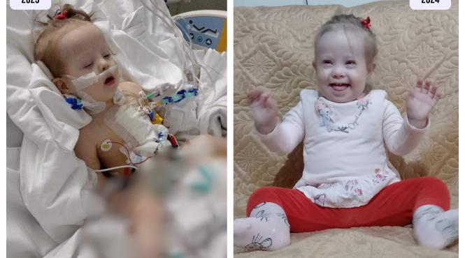 mariuta avea doua gauri in inima la un an de la operatie copila din bucovina este perfecta