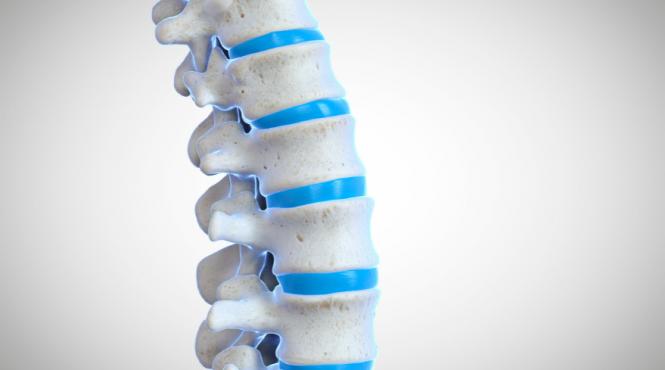 stenoza spinala neurochirurgie presiune maduva