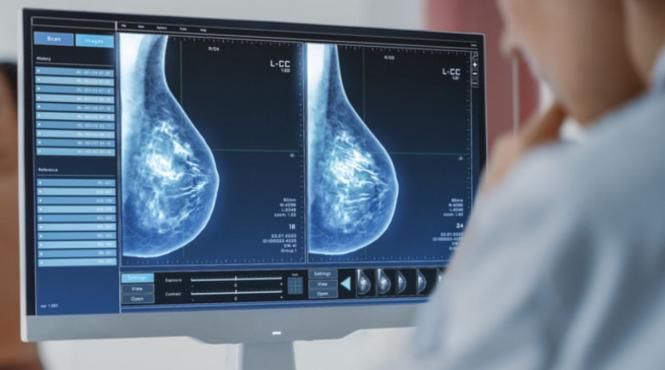 imbolnaviri cancer nivel global estimari decese