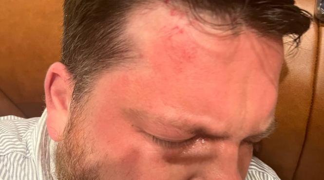 leonid volkov mana dreapta navalnii atacat ciocanul