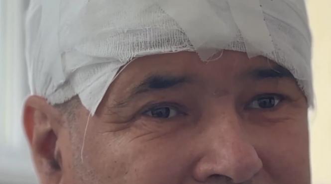 lacrimi fericire tumora cerebrala gigant operata succes iasi