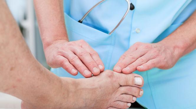 ce trebuie sa stii despre guta simptome si tratament