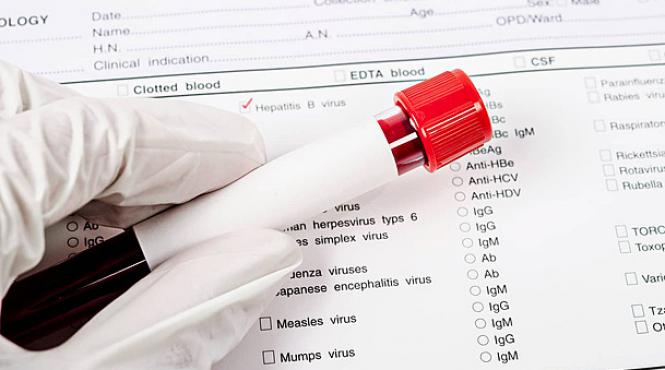 test salivar cancer prostata test sange