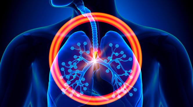 reguli angajatori muncitori azbest valori cancer