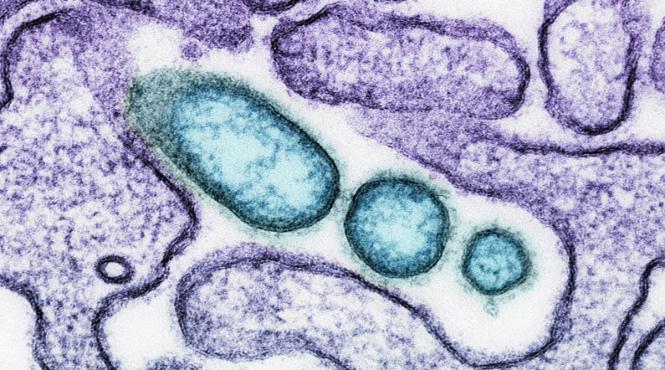 antibiotic gonoree tratament infectiei rezistente medicamente gepotidacin