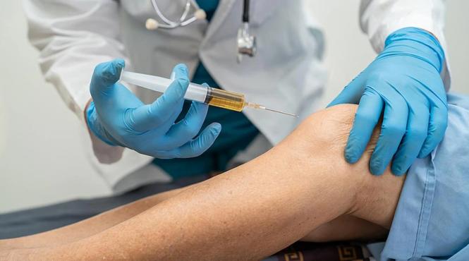 dr mihai baican terapia prp rezultate regenerare