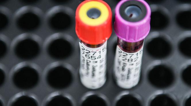 test sange hemoleucograma depistare cancer