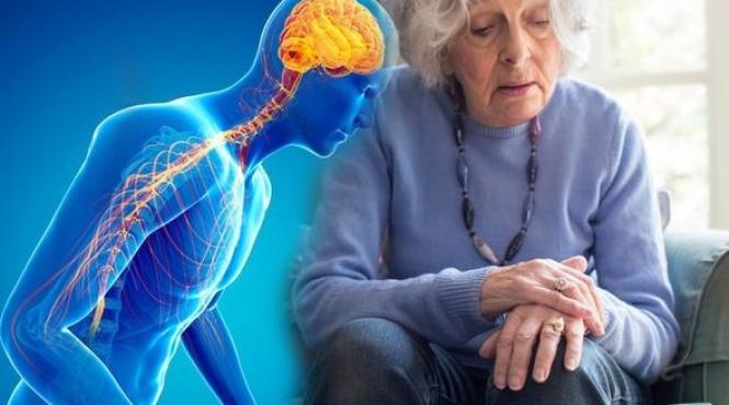 medicament inovativ parkinson