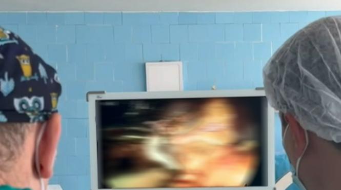 procedura laparoscopic spital