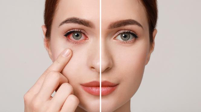 ulcior ochi nu este banal monica pop explica greseli pacienti