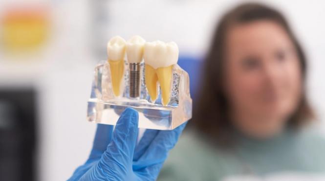 recuperarea dupa implant dentar ce trebuie sa stii