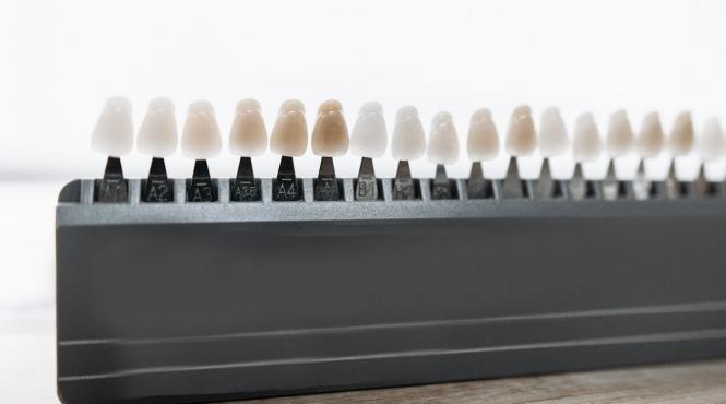 upgrade dental estetica dentara redefinita prin solutii moderne