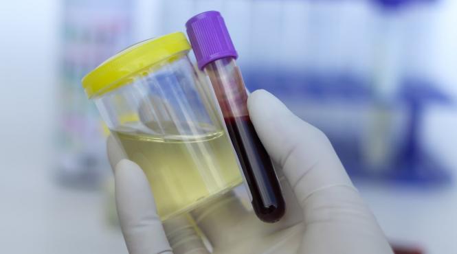 revolutie in sistemul medical analizele de sange direct la medicul de familie