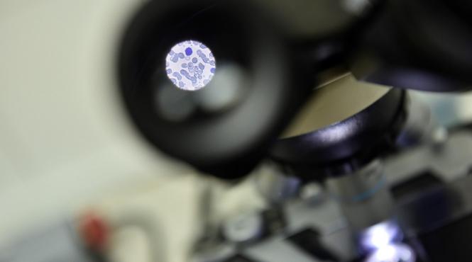 vierme mic dezvaluit mare secret viata lunga