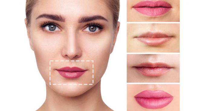 cum sa alegi tratamentul potrivit pentru marirea buzelor cu acid hialuronic in bucuresti