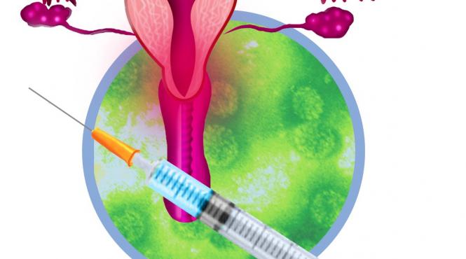 romania mortalitate cancer col uterin