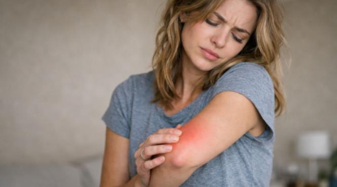 mahmureala pielii exista ce se intampla cu tenul dupa excesul de alcool