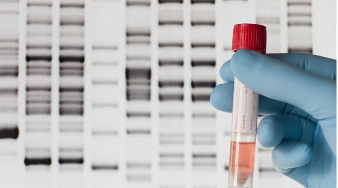 test nutrigenetic indicatii rezultate si criterii de alegere a laboratorului genetic